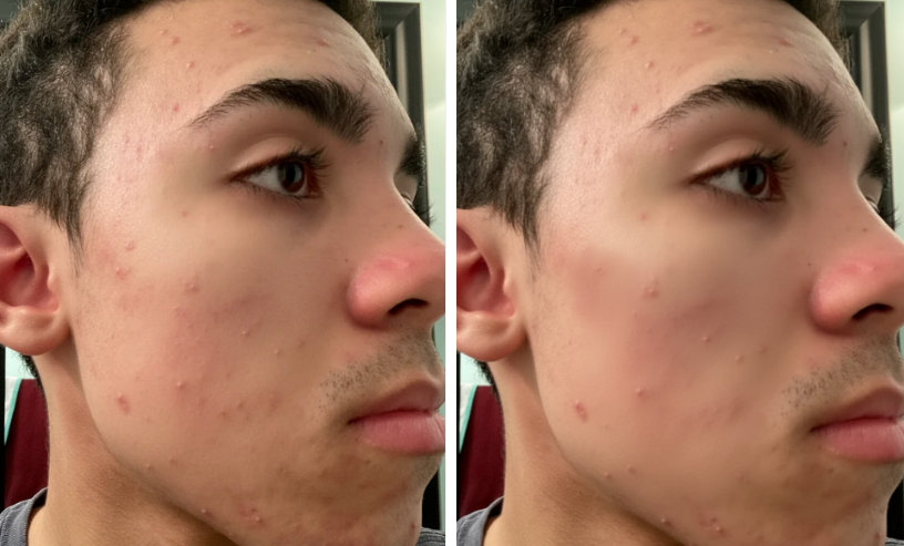 Professional retouching example